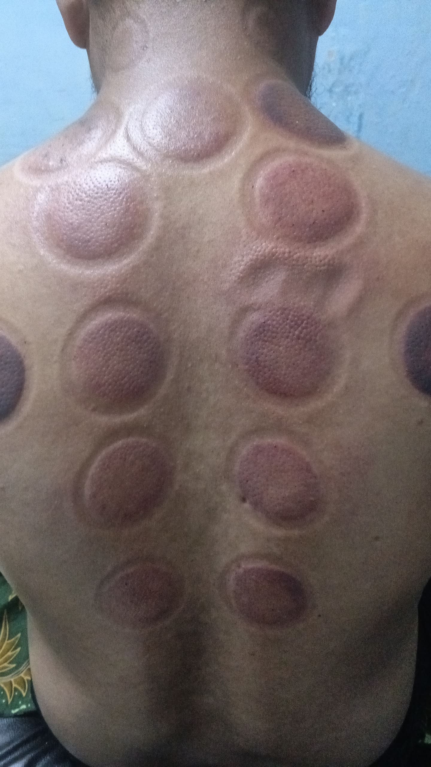 Topung